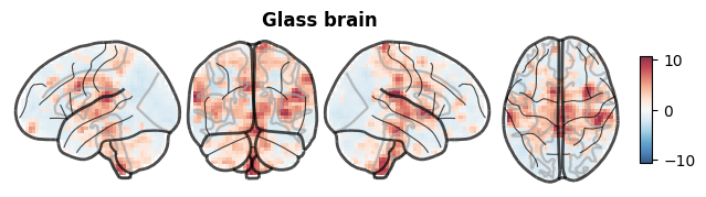 ../_images/nb_introduction_intro08_brainplot_10_2.png