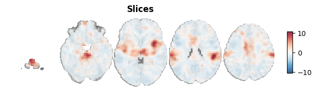 ../_images/nb_introduction_intro08_brainplot_12_2.png