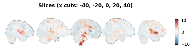 ../_images/nb_introduction_intro08_brainplot_13_2.png