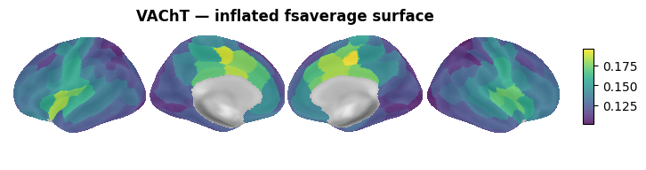 ../_images/nb_introduction_intro08_brainplot_14_2.png