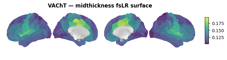 ../_images/nb_introduction_intro08_brainplot_15_2.png