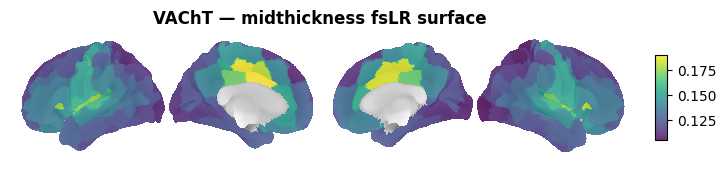 ../_images/nb_introduction_intro08_brainplot_16_2.png