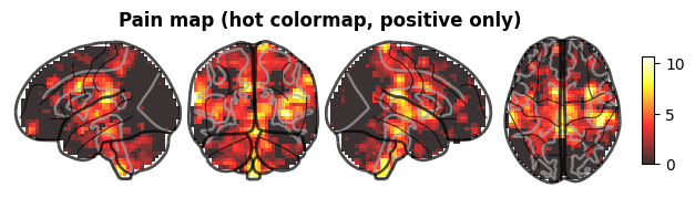 ../_images/nb_introduction_intro08_brainplot_18_2.png