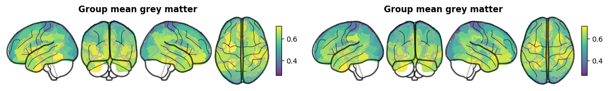 ../_images/nb_introduction_intro08_brainplot_19_2.png