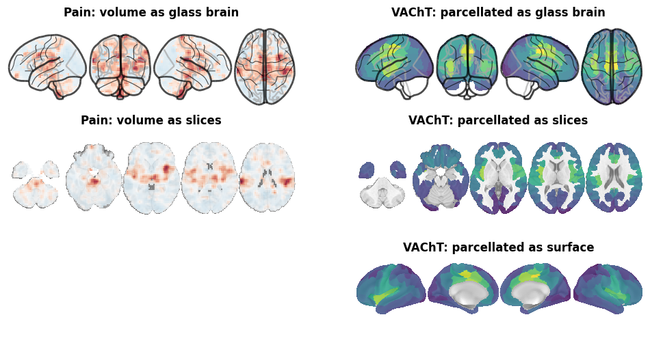 ../_images/nb_introduction_intro08_brainplot_21_1.png
