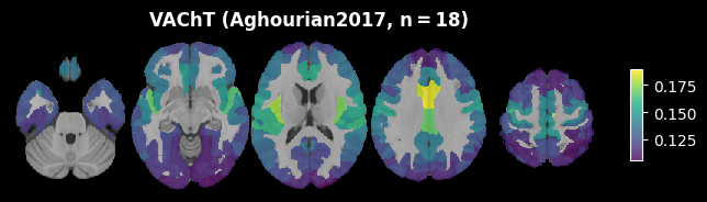 ../_images/nb_introduction_intro08_brainplot_22_3.png