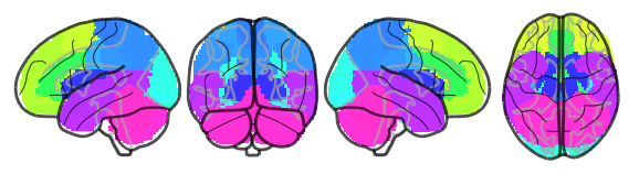 ../_images/nb_introduction_intro08_brainplot_23_3.png
