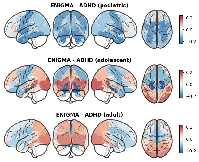 ../_images/nb_introduction_intro08_brainplot_25_2.png