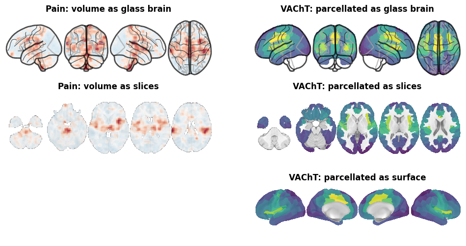 ../_images/nb_introduction_intro08_brainplot_27_1.png