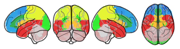 ../_images/nb_introduction_intro08_brainplot_29_3.png