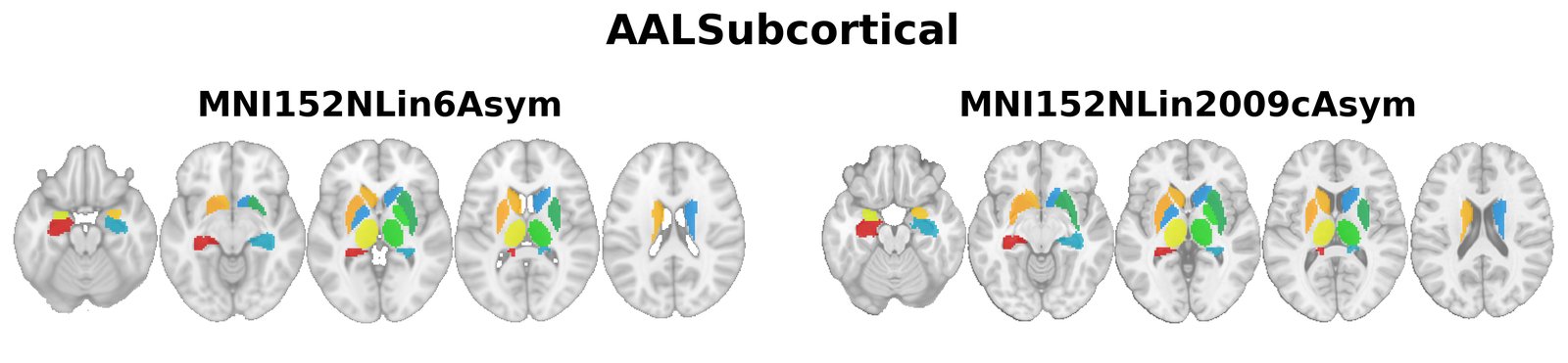 AALSubcortical overview