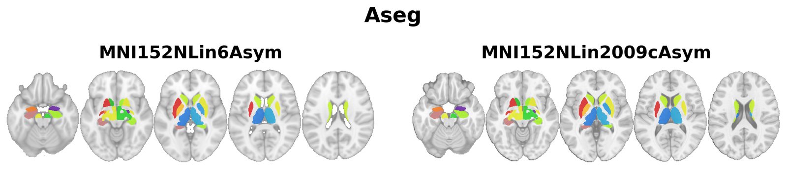 Aseg overview