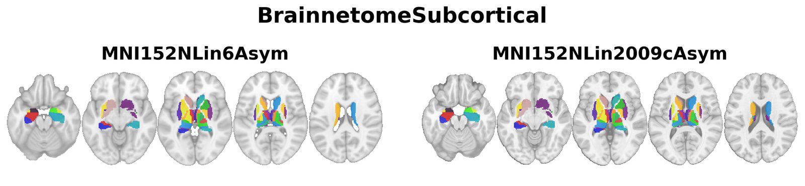 BrainnetomeSubcortical overview