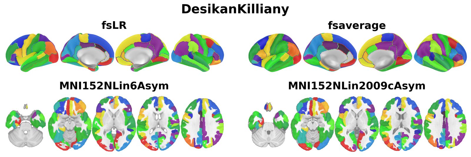DesikanKilliany overview