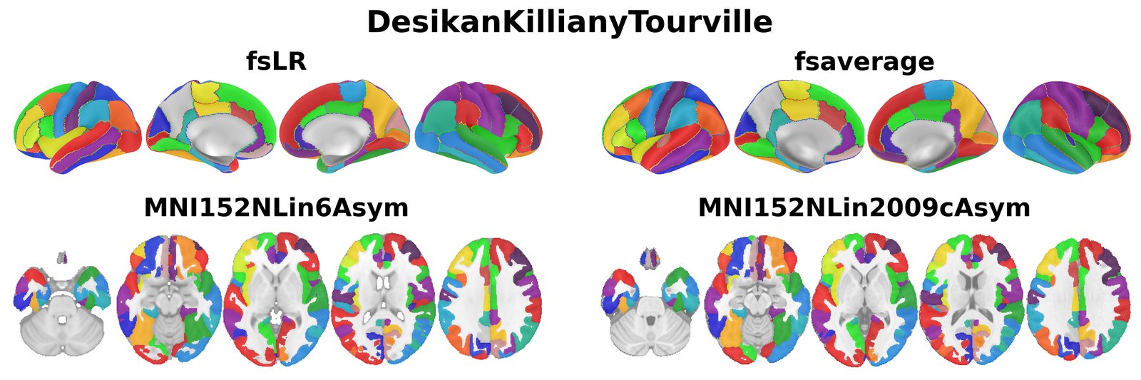 DesikanKillianyTourville overview