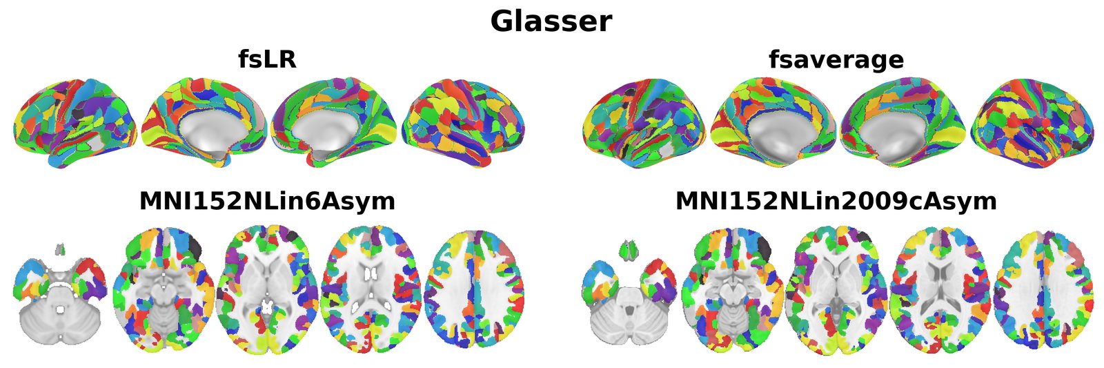 Glasser overview