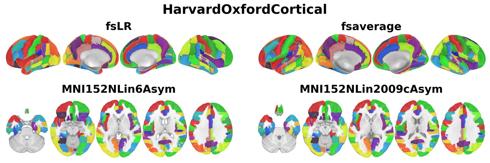 HarvardOxfordCortical overview