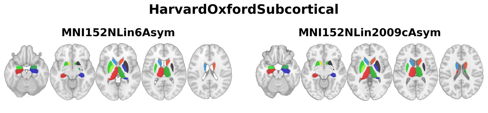 HarvardOxfordSubcortical overview