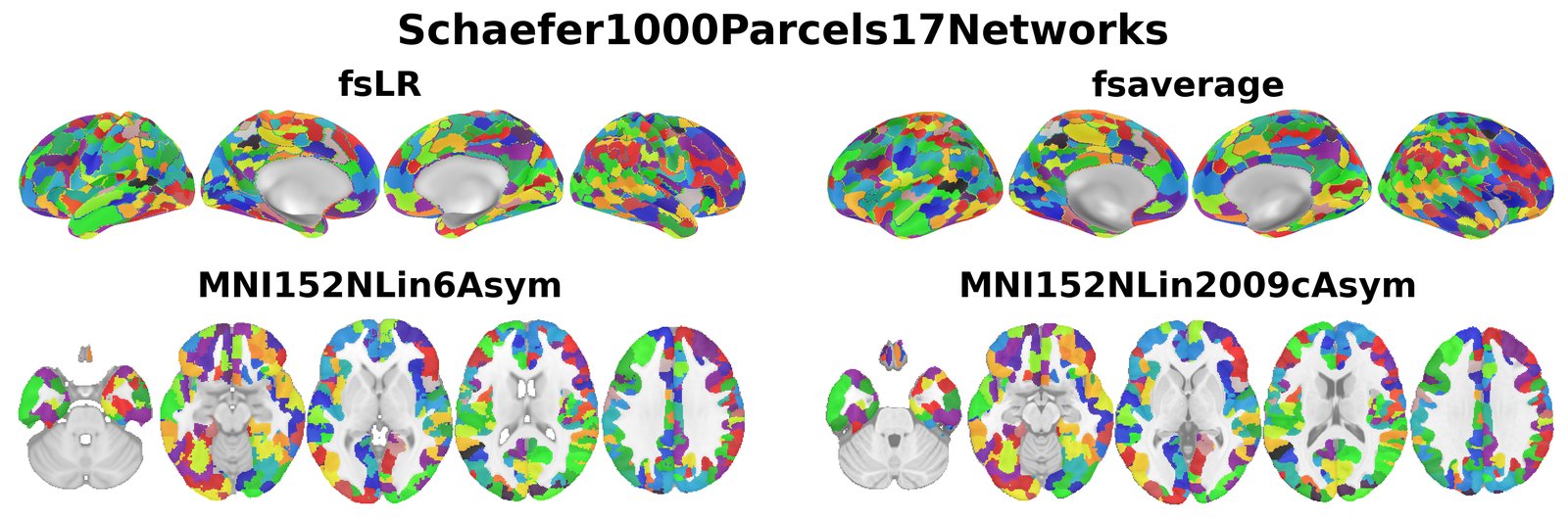 Schaefer1000Parcels17Networks overview