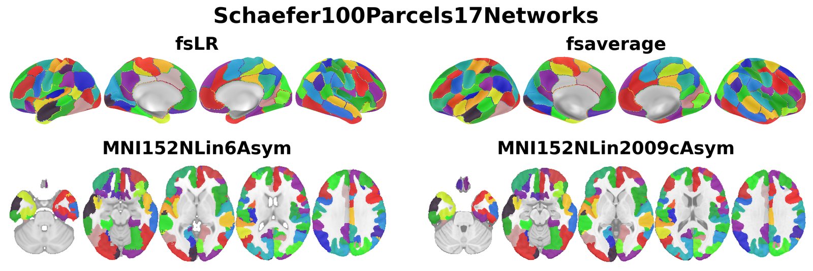 Schaefer100Parcels17Networks overview