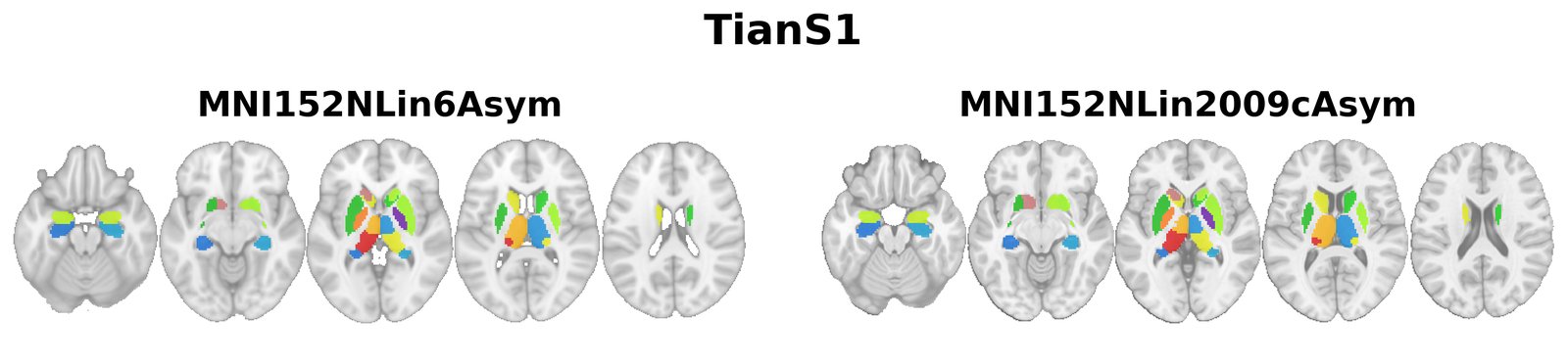 TianS1 overview