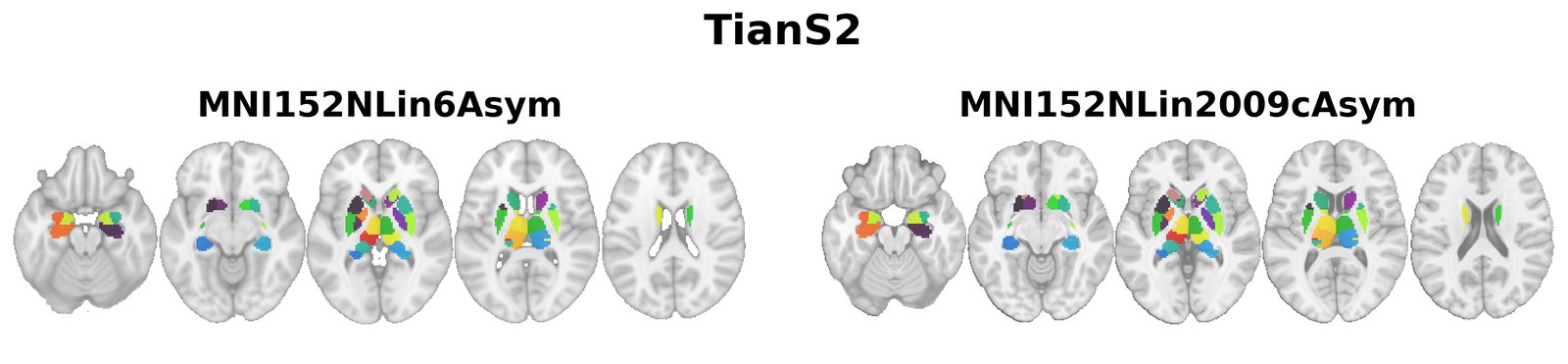 TianS2 overview