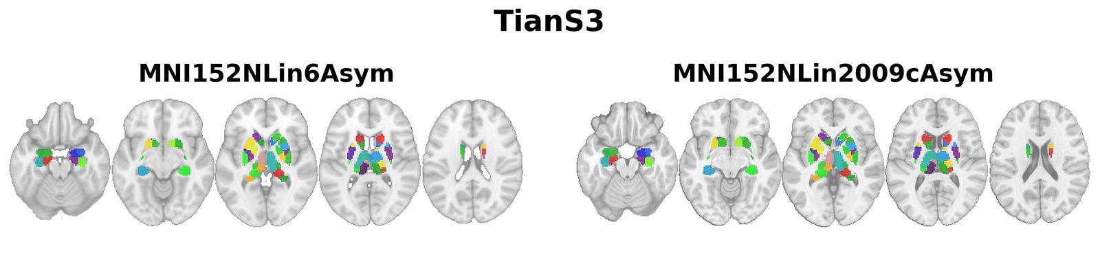 TianS3 overview