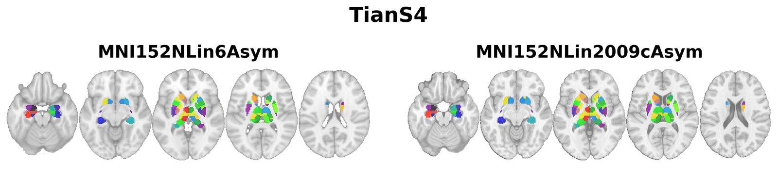 TianS4 overview