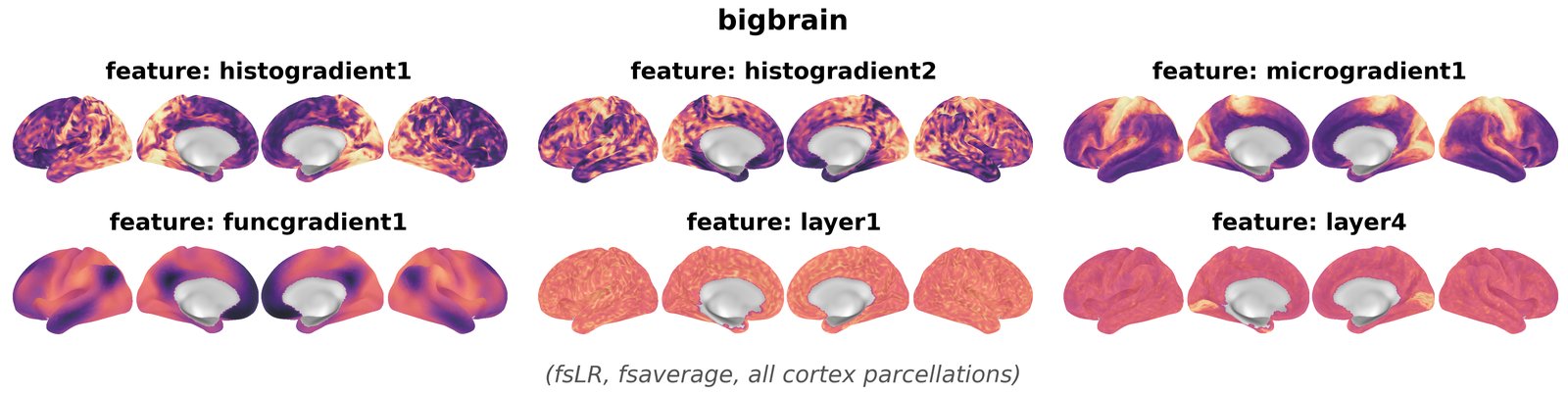 bigbrain overview