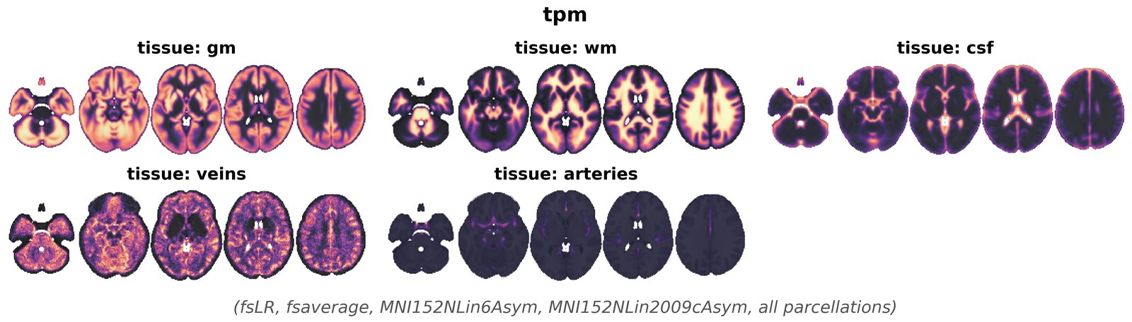 tpm overview