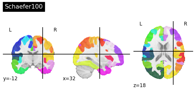 ../_images/nb_introduction_fetching_datasets_36_1.png