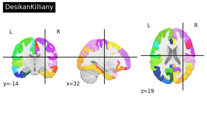 ../_images/nb_introduction_fetching_datasets_36_15.png