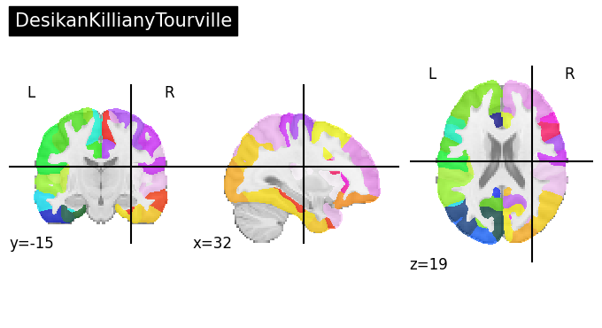 ../_images/nb_introduction_fetching_datasets_36_17.png